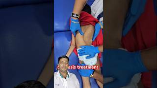 Chiropractic treatment for scoliosis physiotherapy chiropractor baby love backpaintreatment [upl. by Faith]