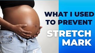 Avoid stretch marks during pregnancy what I used to prevent stretch marks pregnancy stretchmark [upl. by Lynsey]