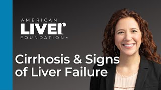 Progression of Liver Disease Webcast Series Cirrhosis and Signs of Liver Failure [upl. by Naro]