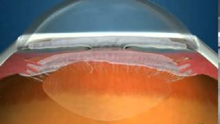 How Fluid Circulates in the Eye [upl. by Zielsdorf69]