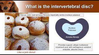 Types of Intervertebral disc disease  from the expert [upl. by Sternick]