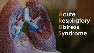 Acute Respiratory Distress Syndrome ARDS for USMLE Step1 and USMLE Step 2 [upl. by Phelgen]