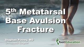 5th Metatarsal Base Avulsion Fracture [upl. by Aneras]