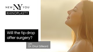 RHINOPLASTY quotWill the Tip Drop After Surgeryquot with Dr Onur Gilleard [upl. by Savitt330]