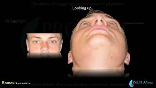 Orthognathic Jaw surgery amp oral and maxillofacial surgery using CT 3D imaging [upl. by Britte38]