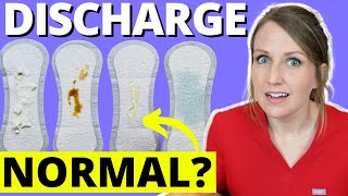 Doctor Answers Top 5 Discharge Questions [upl. by Onirefes]