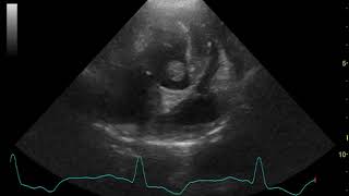 Echocardiography canine infective endocarditis [upl. by Colier296]