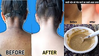 काली गर्दन को 10 मिनट में गोरा बनायें Kali Gardan Ko Gora Karne ka Tarika Neck Skin Whiten [upl. by Cir]