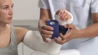 Plaster of Paris Elbow Splint Application [upl. by Kashden]