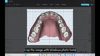 Maestro 3D  Dental Studio  User Video Tutorials  How to customize archform [upl. by Ezra]