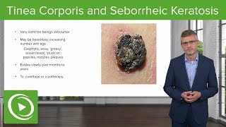 Tinea Corporis Ring Worm and Seborrheic Keratosis – Dermatology  Lecturio [upl. by Willett]