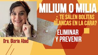 MILIUM o MILIAN ¿Te salen BOLITAS BLANCAS EN LA CARA Cómo ELIMINAR Y PREVENIR [upl. by Neeli]