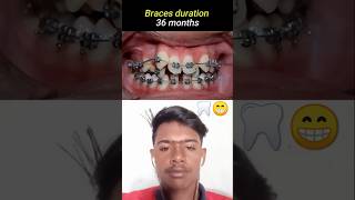 How to treat teeth viralreels viralytshorts viralshortsviralvideo trending dentist medical [upl. by Pilloff]