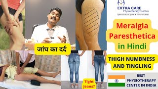 MERALGIA PARESTHETICA IN HINDI  जांघ का दर्द  Thigh Numbness Burning and Pain  Fully Explained [upl. by Namwen]