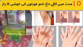 Dark skin whitening creamHands and foot whitening cream [upl. by Ebba772]