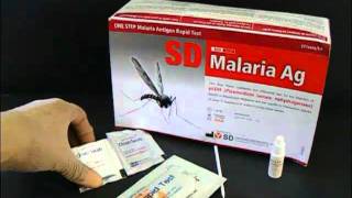 Malaria Antigen Rapid Test [upl. by Endys]