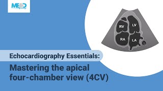 Echocardiography Essentials Mastering the apical fourchamber view 4CV [upl. by Adnawad417]