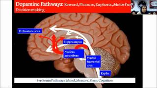 Transcranial Direct Current Stimulation by DrLinda Sherine [upl. by Notkcorb]