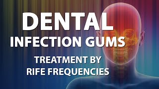 Dental Infection Gums  RIFE Frequencies Treatment  Energy amp Quantum Medicine with Bioresonance [upl. by Botti]