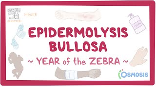 Epidermolysis Bullosa Year of the Zebra [upl. by Streetman615]