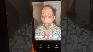 Vitiligo Recovery Incredible Transformation with Ayurveda [upl. by Enitsirhc478]