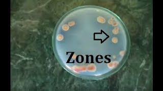 How to isolate phosphate solubilizing bacteria [upl. by Marga496]