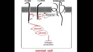 Unraveling profibrotic pathways in the kidney [upl. by Yc674]