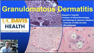 DERMATOPATHOLOGY Granulomatous Dermatitis [upl. by Novoj]