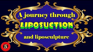 A journey through liposuction and liposculpture Part 510 [upl. by Idonna]