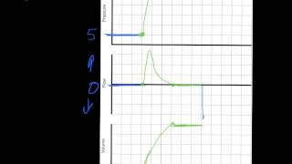 Ventilator Mode amp Waveforms Review [upl. by Gertrude277]