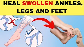 Say Goodbye to Swollen Feet Ankles amp Legs Once With These Proven Tips I Health amp Nutrition [upl. by Iggep]