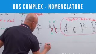 ECG  QRS Complex in EKG  Nomenclature  Electrocardiography🫀 [upl. by Ras75]