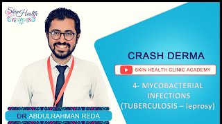 4  MYCOBACTERIAL INFECTIONS شرح الجلدية الجزام والدرن دعبدالرحمن رضا [upl. by London800]