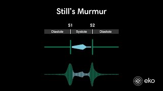 Stills Murmur Recording amp Waveform  Eko Health [upl. by Beauregard]