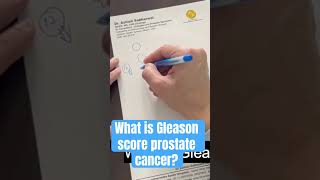 Understanding Gleason score Prostate cancer [upl. by Ognimod]