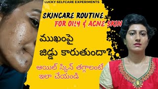 Skincare routine for oily and acne skin in telugu  remove acne acne marks blackheads whiteheads [upl. by Bran]