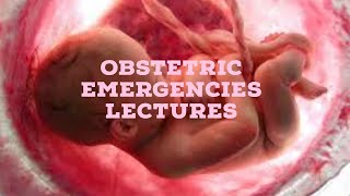 OBSTETRIC EMERGENCIES lecture 2 POST PARTUM HEMORRAHGE all important points [upl. by Field]