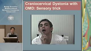 Oromandibular Dystonia and Meige Syndrome Virgilio Gerald H Evidente MD [upl. by Juna]