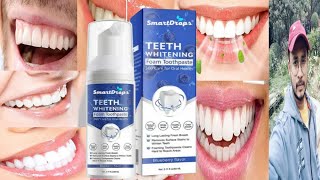 Smart Drops Teeth Whitening Foam Toothpaste  Honest Review [upl. by Sialac]