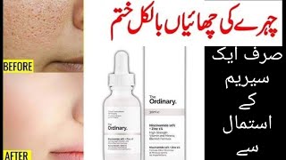 the ordinary niacinamide serum review in urdu i got shocking results by the use of 1 bottle [upl. by Bird]