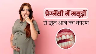 Bleeding Gums During Pregnancy Causes and Treatmentक्या प्रेग्नेंसी में गम ब्लीडिंग होना सामान्य है [upl. by Buckels]