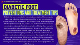 Diabetic Foot Health Tips for Care Prevention and Treatments diabeticfootcare theradiology5817 [upl. by Errick412]