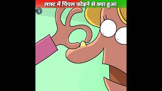 लास्ट में पिंपल फोड़ने से कुछ ऐसा हुआ😱 shorts ytshorts hindi india MRINDIANHACKER CrazyXYZ [upl. by Pomeroy]