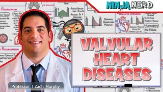 Valvular Heart Diseases  Clinical Medicine [upl. by Chadwick]