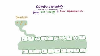 Primary biliary cholangitis causes symptoms diagnosis treatment amp pathology [upl. by Naresh]