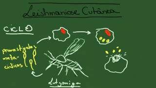 Leishmaniose Tegumentar Americana  Resumo  Parasitologia [upl. by Dnomaid354]