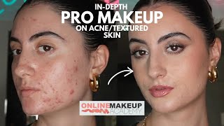 PROFESSIONAL MAKEUP ON ACNETEXTURED SKIN  Indepth Application with Online Makeup Academy [upl. by Ativoj]