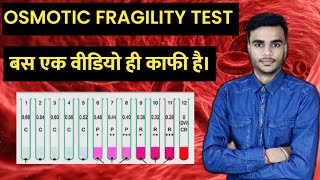 Osmotic Fragility Test  Osmotic Fragility Test In Hindi  What Is Oft  Medical Plus Point [upl. by Tesler249]