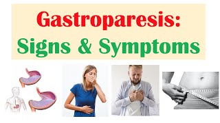 Gastroparesis Signs amp Symptoms ex Nausea Abdominal Pain Weight Loss [upl. by Aisel]