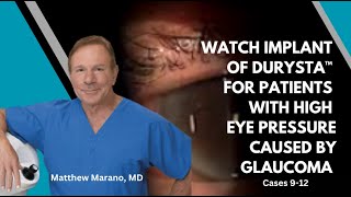 Watch implant of DURYSTA™ for patients with high eye pressure caused by glaucoma cases 9  12 [upl. by Anawed]